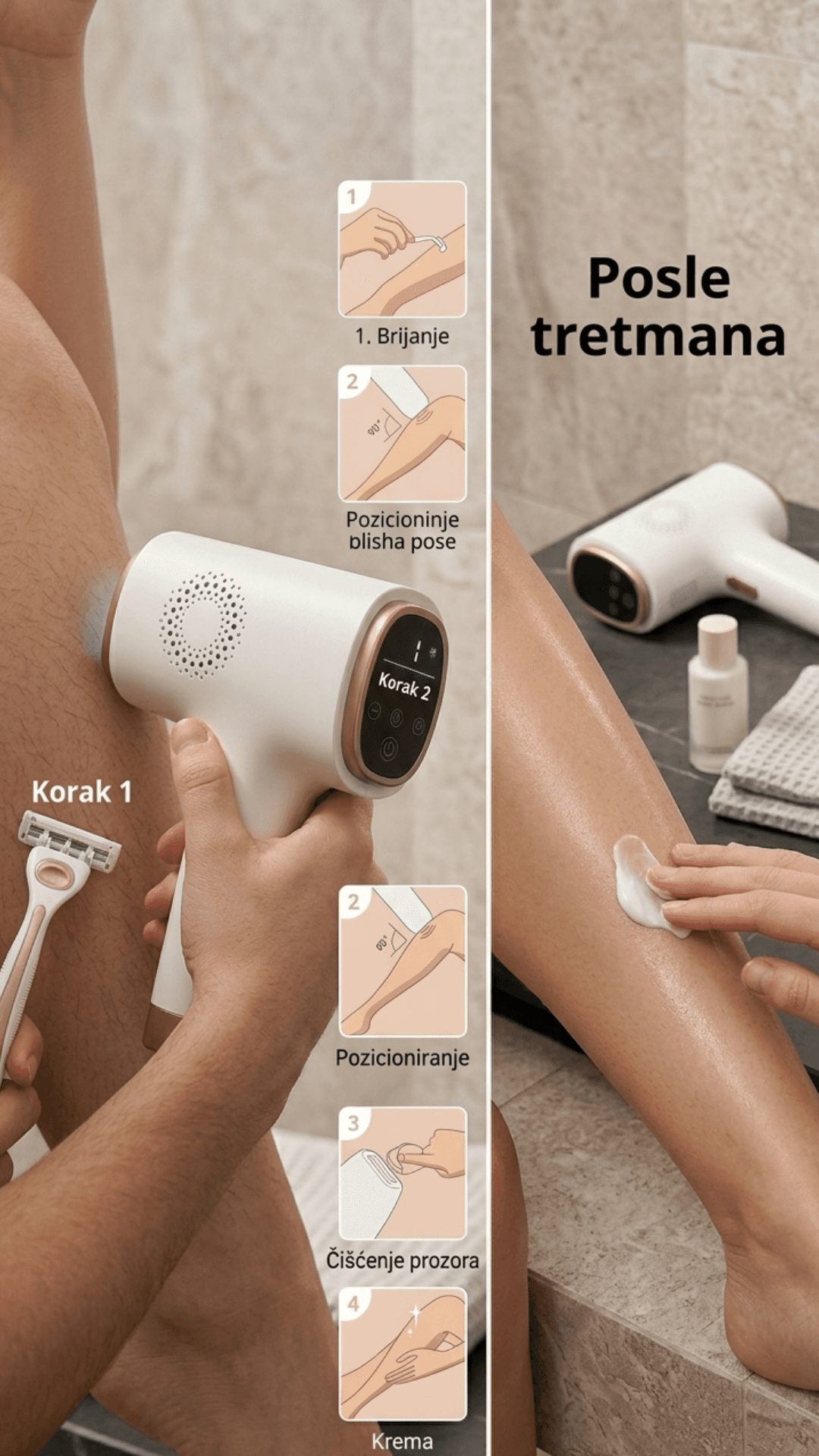 Rezultati korištenja ICE COOL PRO IPL uređaja